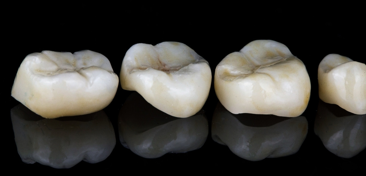 _impact of dental crowns on oral health